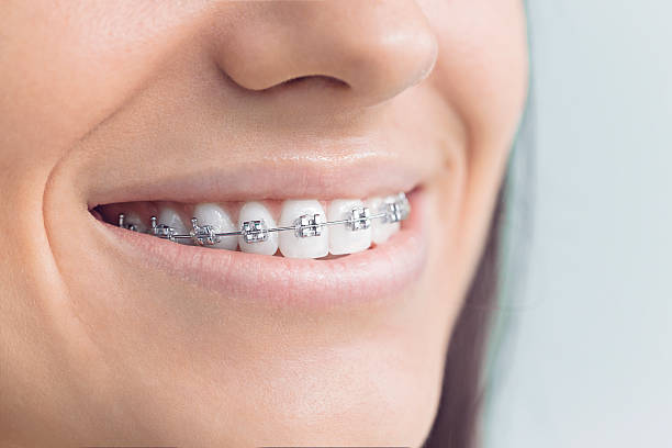 Best Root Canal Treatment  in White Hall, IL